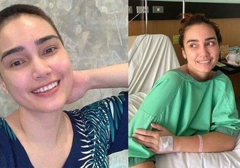 Feby Febiola Menderita Penyakit Kista hingga Cukur Habis Rambutnya, 4 Makanan Favorit Ini Ternyata Jadi Penyebabnya, Wanita Wajib Baca!