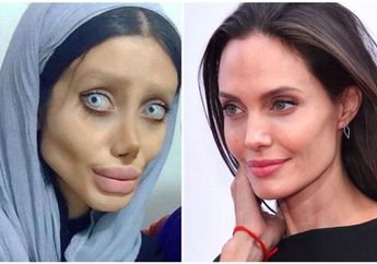 Sempat Viral Gara-gara Wajahnya Hancur Total setelah Oplas Agar Mirip Angelina Jolie, Wanita Ini Kini Nasibnya Sungguh Mengenaskan, Meringkuk di Penjara Sambil Menderita Covid-19