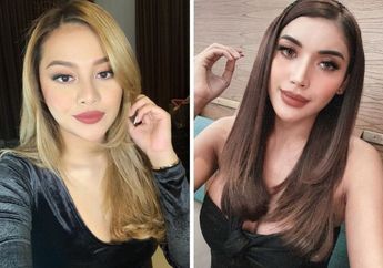 Aurel Hermansyah Kalah Telak! Segini Biaya Fantastis Permak Wajah dan Tubuh Millendaru, Ashanty: 'Kalah Kamu Kak'