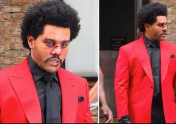 Bikin Fans Khawatir, The Weeknd Muncul dengan Wajah Babak Belur di Ajang MTV Awards 2020, Habis Berkelahi?