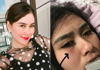 Tak Ada Angin Tak Ada Hujan, Tetiba Syahnaz Sadiqah Unggah Potret Menangis, Bagian Bawah Matannya Memar dan Bengkak, Ada Apa?