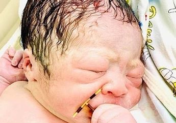 Foto Bayi Baru Lahir Pegang Alat Kontrasepsi Bikin Geger, Dokter di Rumah Sakit Jelaskan Kronologi Kejadiannya