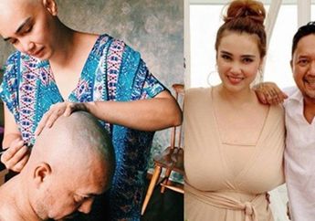 Unggah Foto Botak Karena Derita Penyakit Berbahaya, Feby Febiola Malah Dituduh Kena Karma Masa Lalu, Respons Sang Suami Bikin Netizen Terdiam