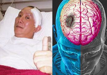 Renggut Nyawa Banyak Artis, Ternyata 1 Bulan Sebelum Stroke Menyerang, Tubuh Akan Alami Pertanda dan Gejala Ini! Catat Baik-baik