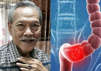 Jangan Anggap Sepele! Susah BAB Ternyata jadi Awal Penyakit Kanker Usus yang Renggut Nyawa Aktor Senior ini, Hati-hati!