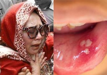 Renggut Nyawa Ibunda Nunung, Gejala Awal Kenker Lidah Ternyata dari Kondisi yang Sering Kita Rasakan ini, Jangan Diabaikan!