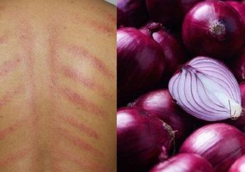 Jadi Obat Nenek Moyang yang Bikin Kebal Penyakit, Cobain, deh, Kerokan dengan Bahan Dapur Ini! Dijamin Ampuh