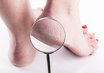 Atasi Telapak Kaki Kasar & Pecah-Pecah dengan DIY Foot Mask Ini. Super Mudah!