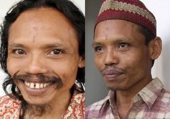 Disuntik Vaksin Covid-19, Sumanto si Manusia Kanibal Justru Lontarkan Kalimat Tak Terduga Ini hingga Buat Perawat Bereaksi