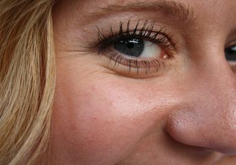 5 Cara Menghilangkan Kerutan Mata Menurut Ahli Dermatologi, Ikuti Yuk!