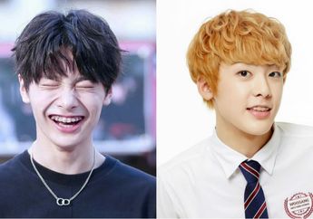 7 Idol KPop Ini Terlihat Imut Pakai Behel Saat Udah Debut. Gemes!
