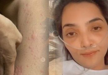 Kabar Tak Menyenangkan dari Ashanty, Dokter Temukan Benjolan dalam Kandungan Aurel, Ibunda Arsy Syok
