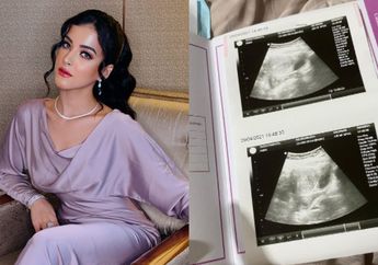 Tasya Farasya Kehilangan Calon Anak Kedua Akibat Keguguran, sang YouTuber Banjir Doa dan Dukungan: Turut Berduka Cita Tasya