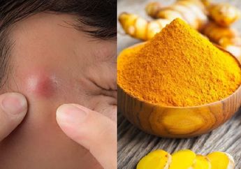 3 Makanan untuk Obat Bisul yang Jauh Lebih Ampuh dari Resep Dokter