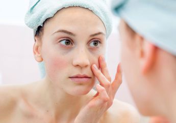 5 Bahan Aktif Skincare yang Harus Dihindari Pemilik Kulit Sensitif
