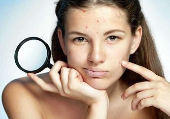 Makin Flawless, Ini 3 Krim Malam Murah Buat Pudarkan Bekas Jerawat!