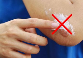 Jangan Panik Kalau Kecipratan Minyak Panas, Ada Cara Ampuh Mengatasinya, Bukan Pakai Odol!