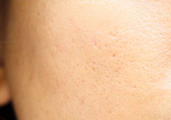 Makin Flawless, Ikuti 5 Cara Jitu Ini Biar Tampilan Pori-pori Mengecil