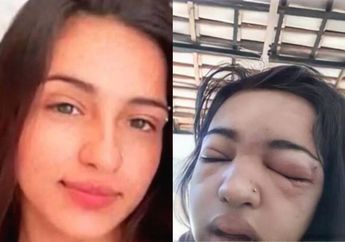 Ngeyel Meski Sudah Dilarang Orangtua, Wanita Ini Tewas Secara Mengenaskan Setelah Menindik Alisnya Sendiri di Rumah