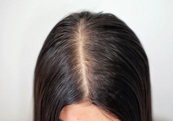 Sering Dilakukan, Padahal 5 Kebiasaan Ini Bikin Rambut Makin Tipis!
