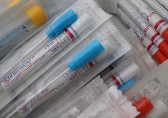 Seolah Tak Ada Kapok-kapoknya, Kembali Terulang Kasus Pemalsuan Surat Hasil Tes Swab PCR Bertarif Rp400 Ribu