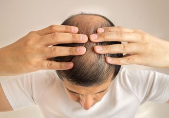 Jangan Tunggu Botak Baru Bertindak! 5 Cara Ini Bisa Dilakukan untuk Mencegah Rambut Rontok, Pecinta Hair Dryer Wajib Hati-hati