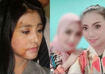 Masih Ingat dengan Kekasih Ferry Irawan yang Dulu Sempat Alami KDRT hingga Pernikahannya Hanya Bertahan 30 Hari? Cici Paramida Tiba-tiba Bagikan Kabar ini : 'Mohon Doanya..'