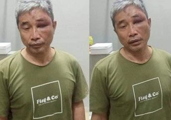 Disebut Lumuri Muhammad Kece dengan Tinja, Jenderal Napoleon Bonaparte Ungkap Fakta Sebenarnya, Foto Tampang Bengap Sang YouTuber Jadi Bukti