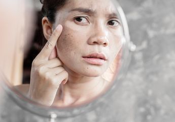 3 Cara Menghilangkan Flek Hitam di Pipi, Pilih Skincare Berbahan Ini