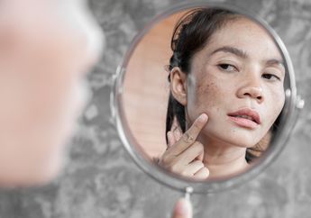 Selain Pakai Krim Wajah, Ini 3 Cara Menghilangkan Flek Hitam yang Bikin Muka Auto Glowing
