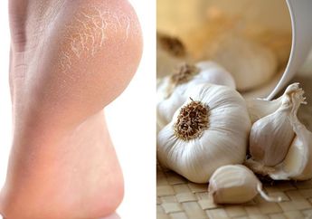 Sebulan Tumit Pecah-pecah Pakai Obat Apa Saka Tak Ampuh, Wanita Ini Iseng Parut Bawang Putih, Hasilnya Langsung Halus Semalam!