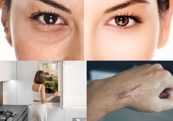 Berita Terpopuler: Cara Menghilangkan Kerutan di Wajah dengan Masker Alami hingga Cara Menghilangkan Keloid