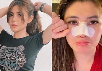 Mau Untung Malah Buntung! Presenter 'Uang Kaget' Angela Lee Nyesel Setengah Mati Hidung Jebol Setelah Operasi Plastik, Penampakannya Bikin Ngeri!