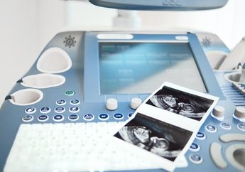 USG 4 Dimensi Murah Meriah, Ibu Hamil Juga Rasakan Manfaat Luar Biasa