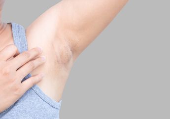 Nggak Sampai Rp100 Ribu, Deretan Produk Ini Bisa Cerahkan Lipatan Hitam