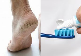 Sekarang Nggak Perlu Pakai Krim Lagi, Tumit Pecah-pecah Langsung Mulus Cuma Modal Odol, Caranya Gampang Banget