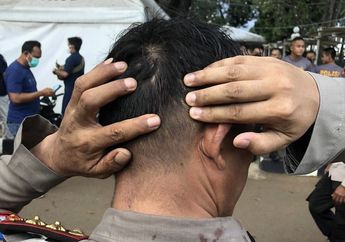 Foto Noda Darah di Seragam AKBP Dermawan Beredar, Perwira Polisi Akui Punya Hubungan Begini dengan Pemuda Pancasila