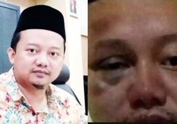 Diduga Herry Wirawan Habis Babak Belur Dihajar Napi Lain di Dalam Penjara, Sosok Ini Bongkar Kondisi Mengerikan Antar Napi di Dalam Bui