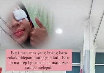 Naik Motor Sambil Merokok Makan Korban, Cewek Ngaku Bola Matanya Sampai Melepuh!