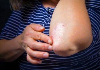 Ini Gejala Luka Dibawah Korengan yang Masih Terinfeksi, Belum Sembuh