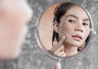 Cuma Butuh Waktu 15 Menit, Singkirkan Flek Hitam Membandel di Wajah Cuma Modal Susu dan Kunyit, Dijamin Hasilnya Bikin Senyum Bahagia!