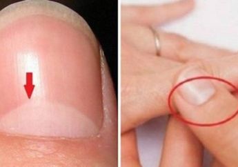 Perhatikan Kuku Anda! Inilah Makna Tanda Putih pada Kuku Melengkung Bak Bulan Sabit Menurut Primbon, Pertanda Baik atau Buruk?