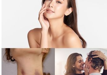 Berita Terpopuler: Begini Cara Memutihkan Wajah dengan Jeruk Nipis hingga 5 Zodiak yang Paling Manja dan Suka Cari Perhatian