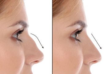 Pertanda Apakah Bentuk Hidung Anda? Primbon Jawa Ungkapkan Sifat Seseorang dari Bentuk Hidungnya, Perhatikan Milik Anda!