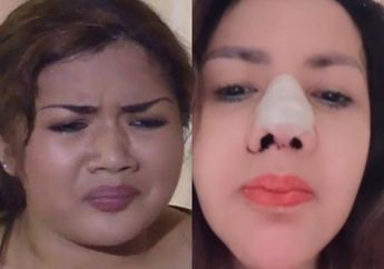 'Tapi Hasilnya Kok...', Waduh! Padahal Sampai Enam Kali Lakukan Operasi Hidung Agar Terlihat Indah, Artis Tanah Air Ini Justru Banjir Hujatan saat Tunjukkan Hasilnya: Pengen Cakep Maksain Banget Sih?