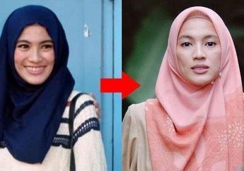 Dulu Cantik dan Berisi, Penampilan Terbaru Alyssa Soebandono yang Kurus dan hingga Wajahnya Sangat Tirus Membuat Warganet Pilu dan Prihatin, Benarkah Sakit Keras?