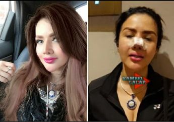 'Infeksi Bernanah jadi Harus Dioperasi' Bikin Merinding! Kondisi Wajahnya Mengerikan Gegara Kepincut Permak di Klinik Abal-Abal, Barbie Kumalasari Tuai Apes Rogoh Kocek Puluhan Juta Untuk Pengobatan