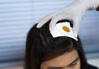 Santai Saja Datangi Rumah Sakit Meski Kepalanya Tertancap Paku, Wanita Hamil di Pakistan Ini Sebut 'Janin' dalam Kandungan Jadi Pemicu