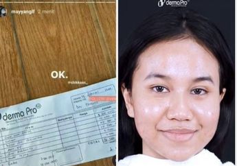 'Perawatan Gitu-gitu Bae', Auto Kena Nyinyir Netizen, Sok-sokan Permak Wajah Hingga Habis Rp 90 Juta, Mayang Syok Bingung Sampai Bayar Pakai Iphone