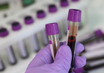 Dicecar China dan Rusia Tentang Laboratorium yang Kembangkan Senjata Biologis, Pihak Ukraina dan AS Akhirnya Buka Suara